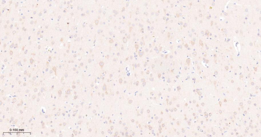 雷帕霉素靶蛋白重组兔单抗