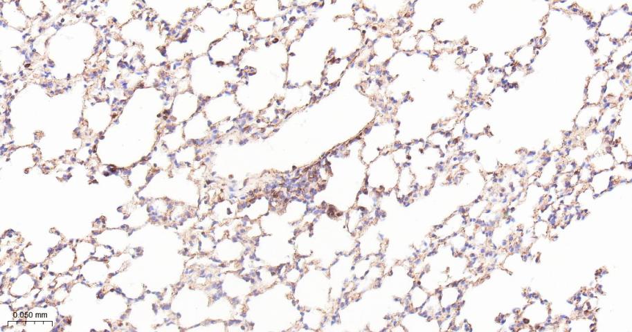 ADAM17重组兔单抗