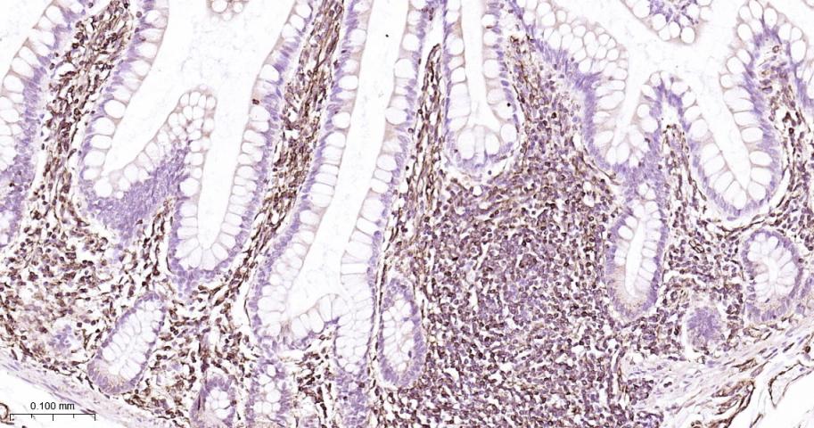 ADAM17重组兔单抗