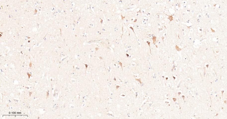 瘦素受体重组兔单抗