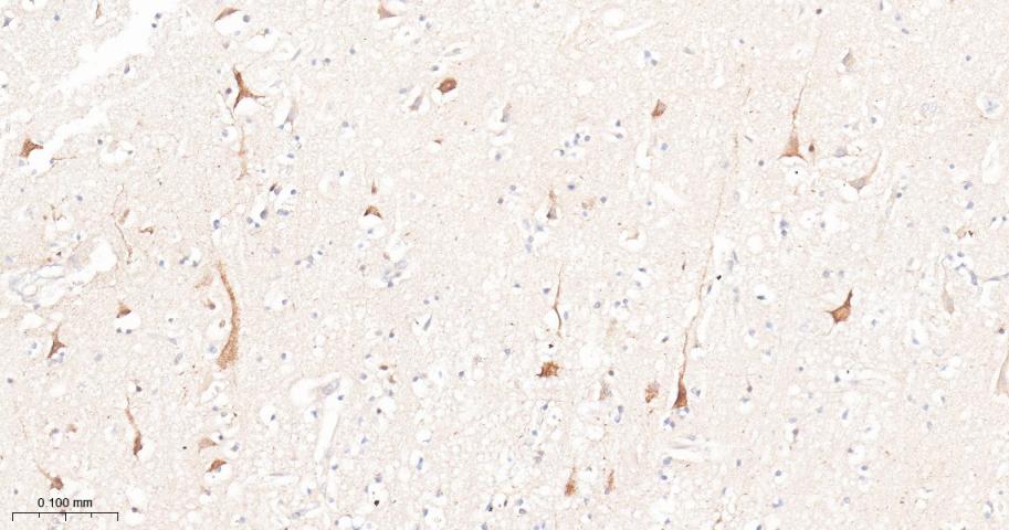 雷帕霉素靶蛋白重组兔单抗