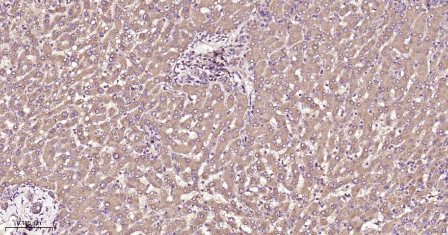 瘦素受体重组兔单抗