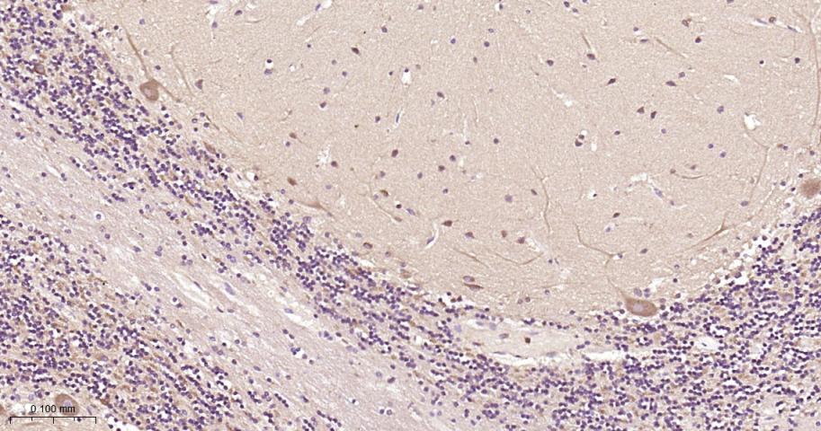 瘦素受体重组兔单抗