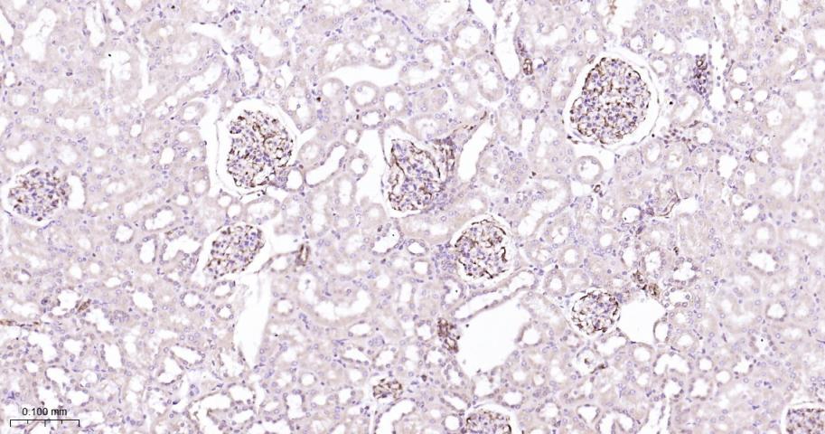 ADAM17重组兔单抗