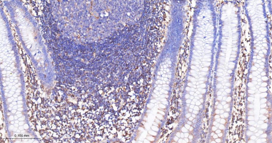 ADAM17重组兔单抗