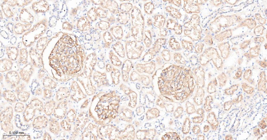 瘦素受体重组兔单抗