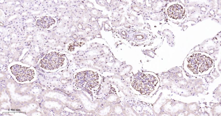 ADAM17重组兔单抗