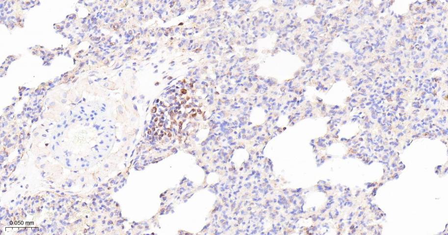 ADAM17重组兔单抗