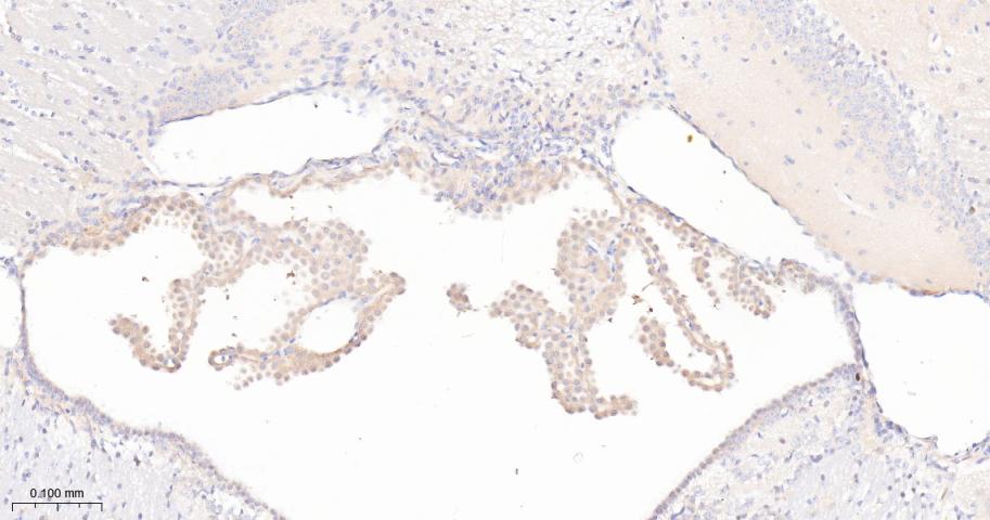 瘦素受体重组兔单抗