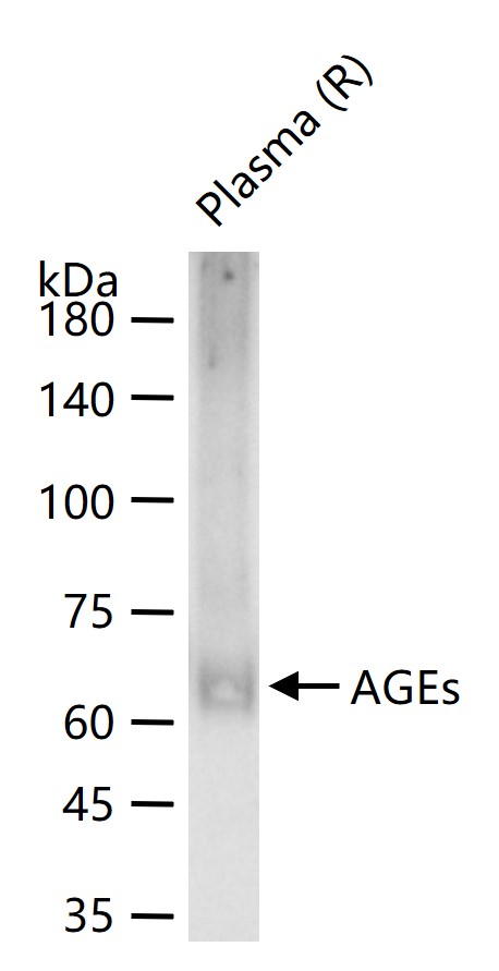 AGEs Rabbit pAb (一抗) - WB,IHC-P,IHC-F,IF,Flow-Cyt | Bioss