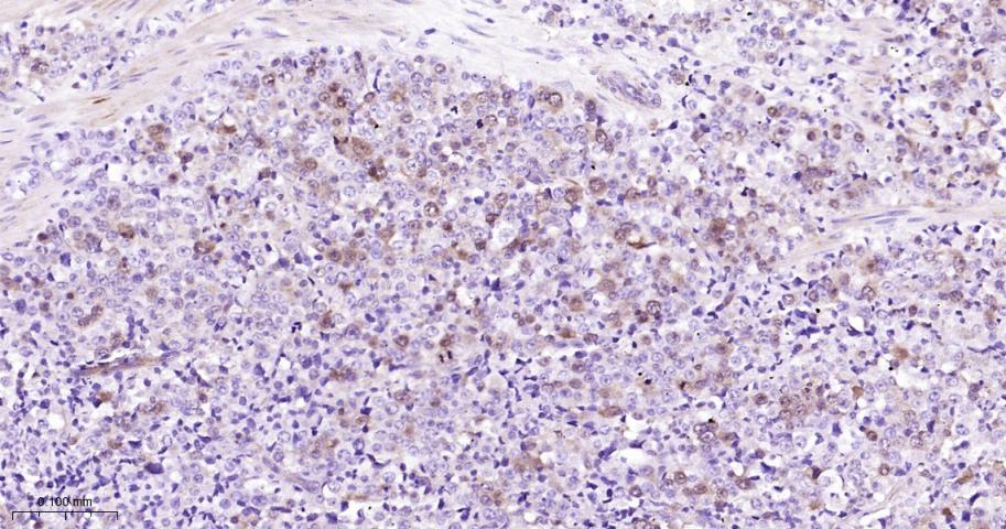 周期素依赖性激酶1重组兔单抗
