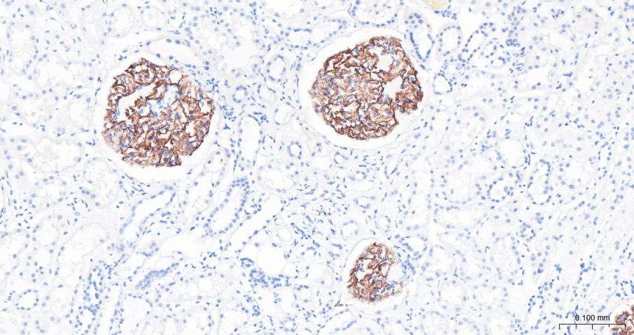 肾小球裂孔膜蛋白PDCN抗体-bs-6597R