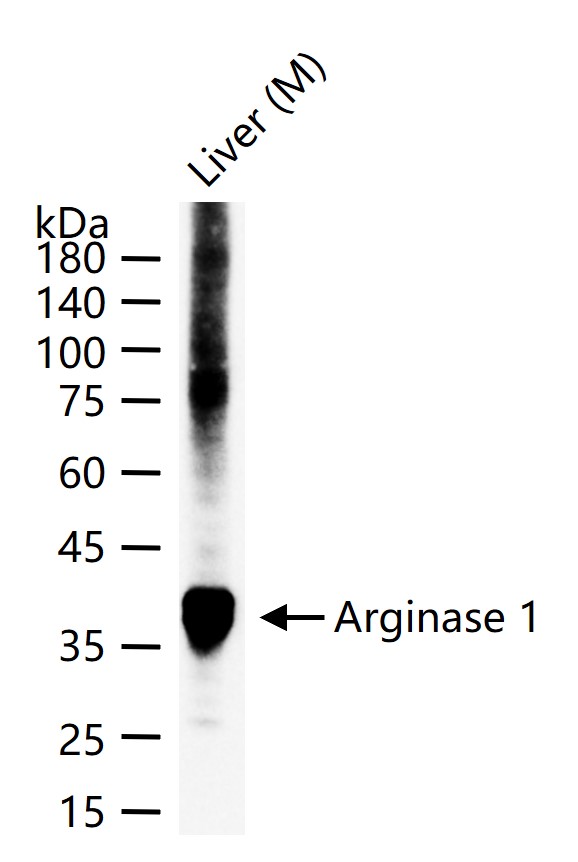 精氨酸酶1重组兔单抗