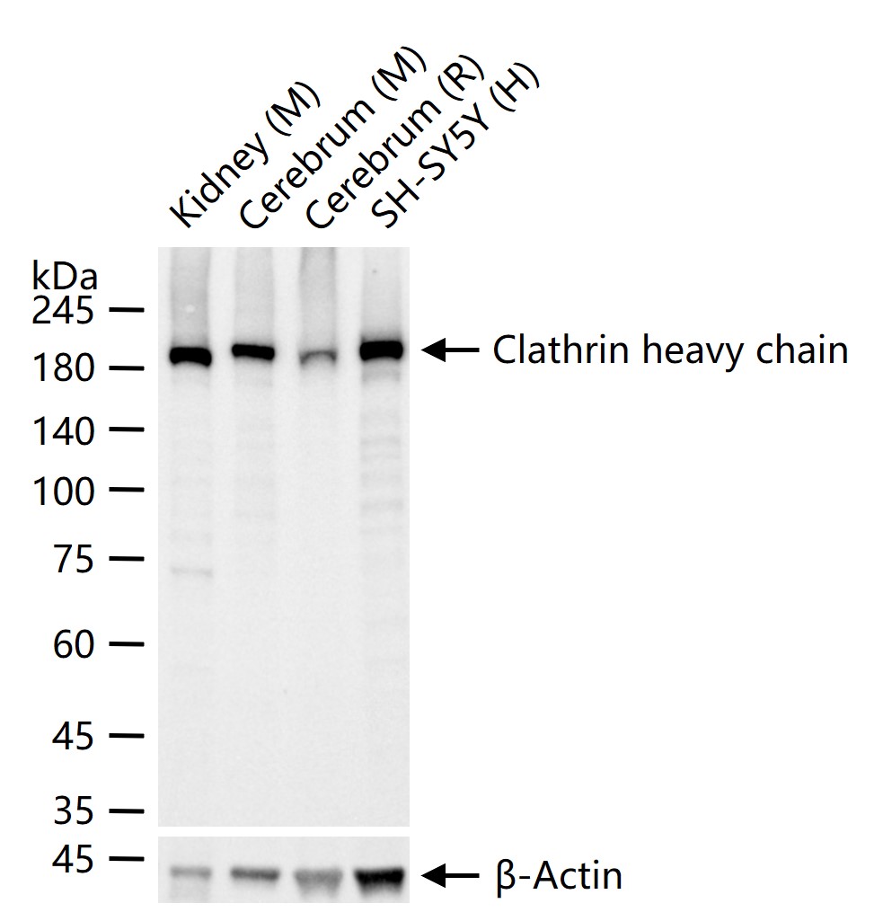 Clathrin heavy chain Recombinant Rabbit mAb (一抗) - WB,IHC-P,IHC-F,IF,ICC/IF | Bioss