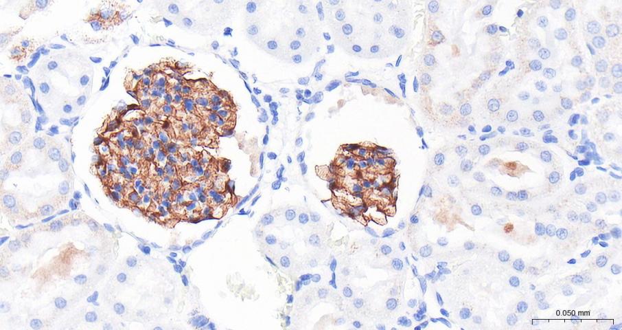 NPHS2 Rabbit pAb (一抗) - IHC-P,IHC-F,IF | Bioss