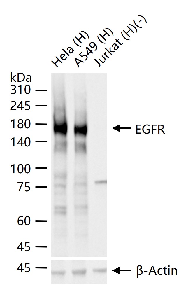 表皮生长因子受体重组兔单抗