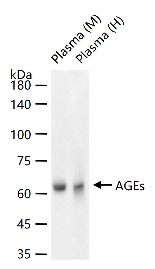 晚期糖基化终末产物抗体-bs-1158R