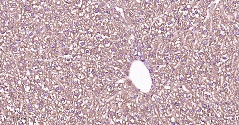 瘦素受体重组兔单抗