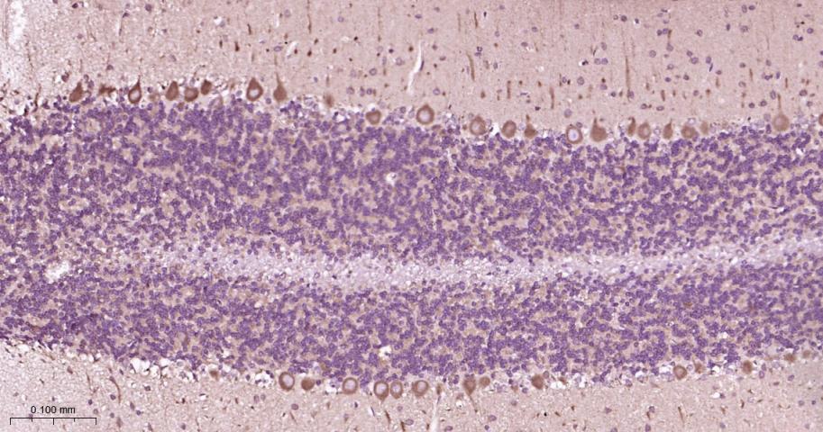 瘦素受体重组兔单抗
