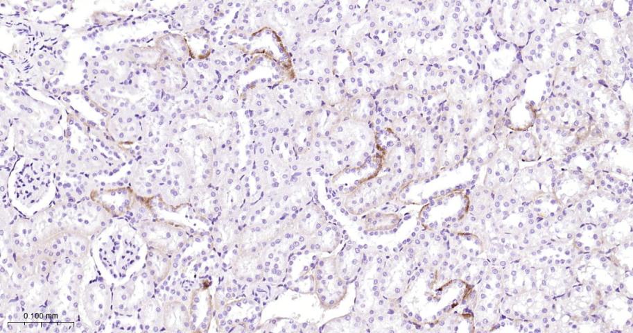 蛋白激酶C重组兔单抗