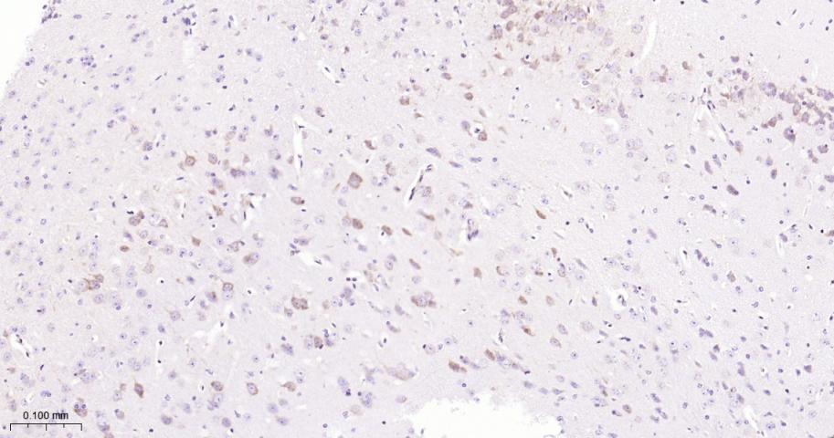 细胞信号转导分子Smad-2重组兔单抗