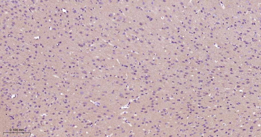 蛋白激酶C重组兔单抗