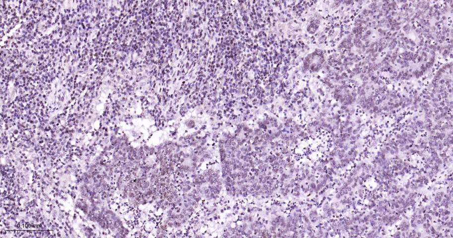 磷酸化信号转导和转录激活因子5a重组兔单抗