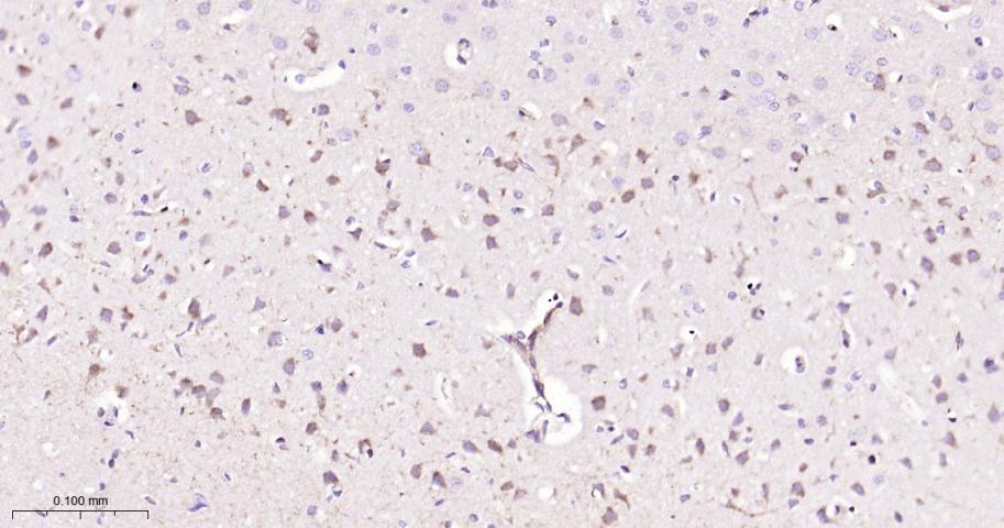 细胞信号转导分子Smad-2重组兔单抗