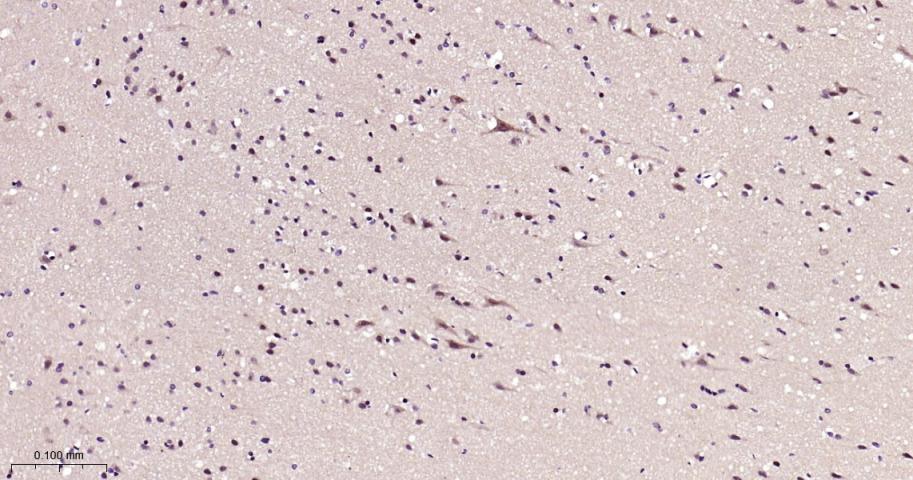 磷酸化雷帕霉素靶蛋白重组兔单抗