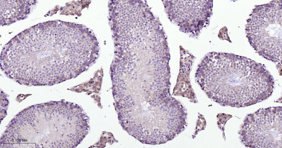 网格蛋白重链重组兔单抗-bsm-61487R