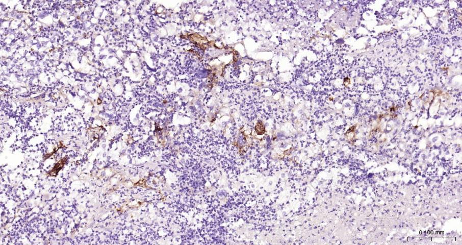 细胞间粘附分子-1（CD54）抗体-bs-0608R