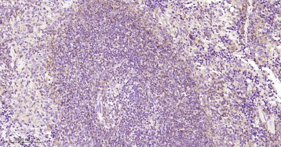 蛋白激酶C重组兔单抗