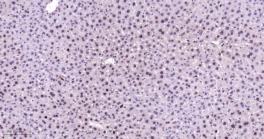 增殖细胞核抗原（内参）重组兔单抗