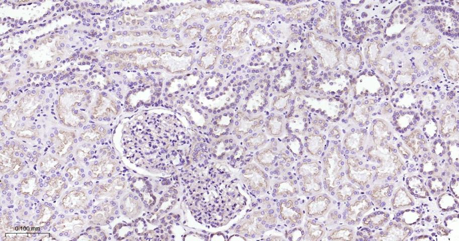 网格蛋白重链重组兔单抗-bsm-61487R