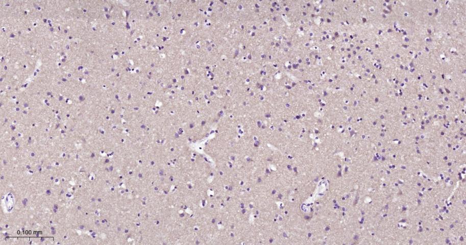 网格蛋白重链重组兔单抗-bsm-61487R