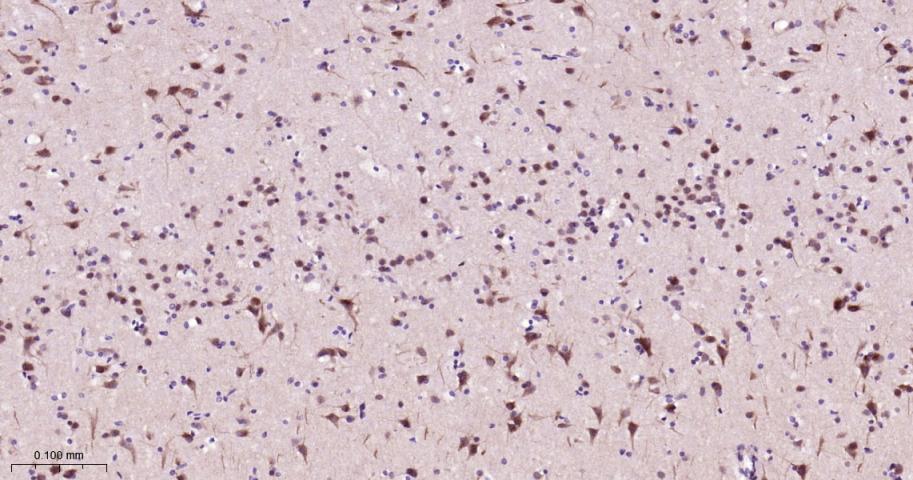 细胞信号转导分子Smad-2重组兔单抗