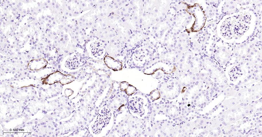 蛋白激酶C重组兔单抗