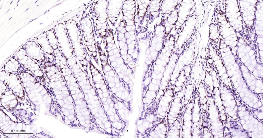 增殖细胞核抗原（内参）重组兔单抗