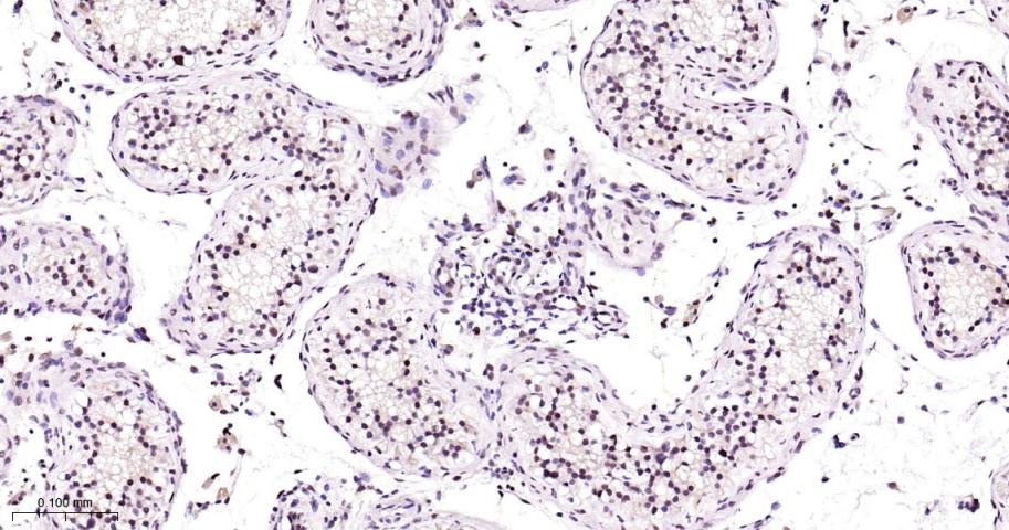 增殖细胞核抗原（内参）重组兔单抗