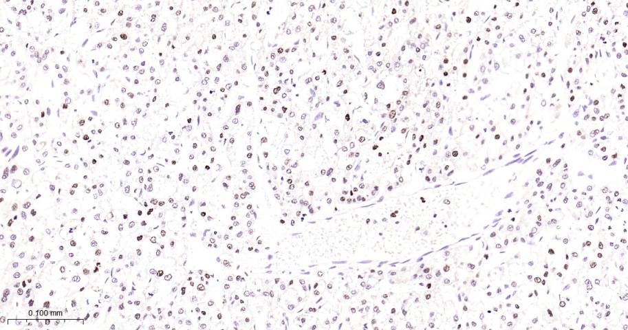 增殖细胞核抗原（内参）重组兔单抗