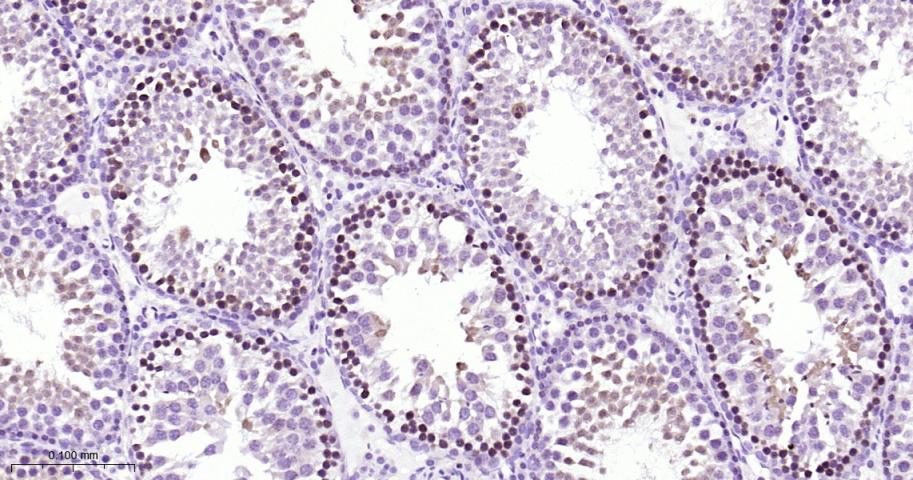 蛋白激酶C重组兔单抗