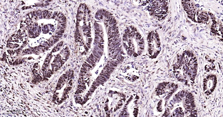 增殖细胞核抗原（内参）重组兔单抗