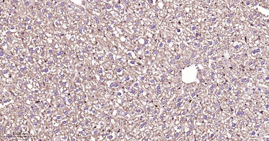 细胞信号转导分子SMAD3重组兔单抗