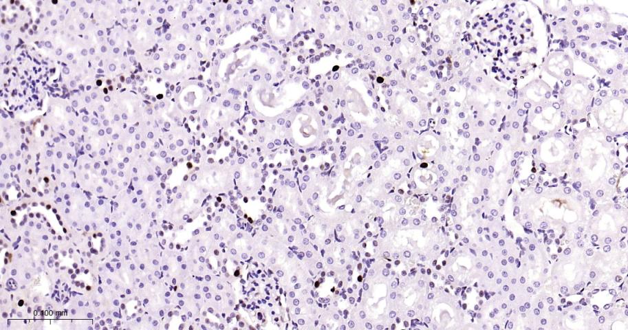 增殖细胞核抗原（内参）重组兔单抗
