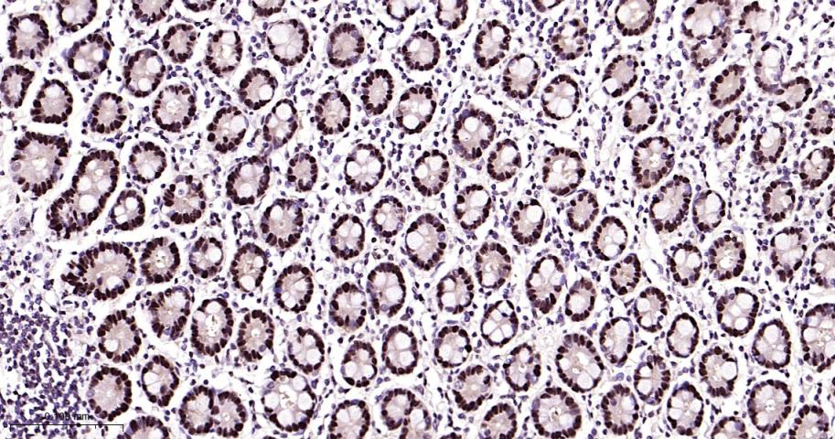 增殖细胞核抗原（内参）重组兔单抗
