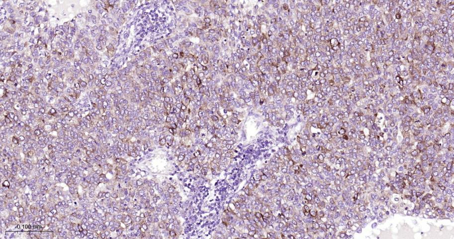 蛋白激酶C重组兔单抗