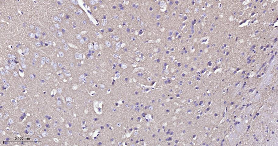 网格蛋白重链重组兔单抗-bsm-61487R