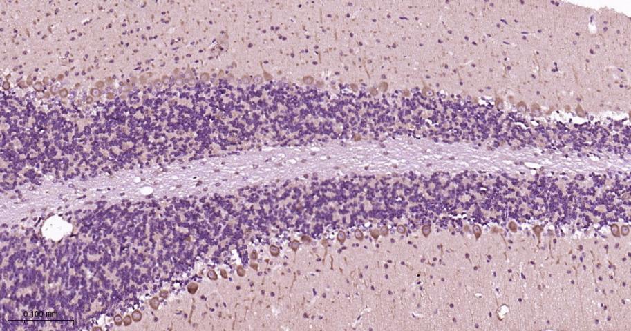 瘦素受体重组兔单抗