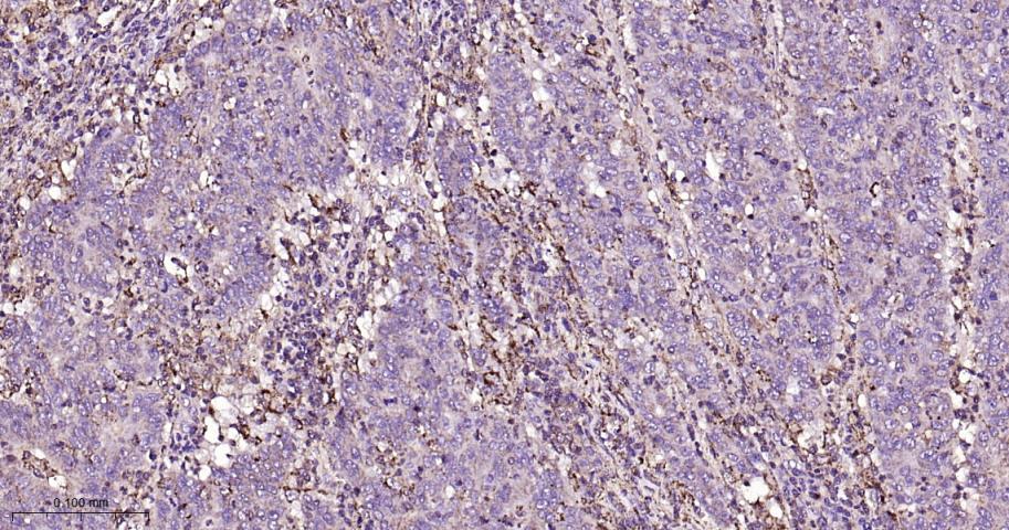 细胞信号转导分子SMAD3重组兔单抗