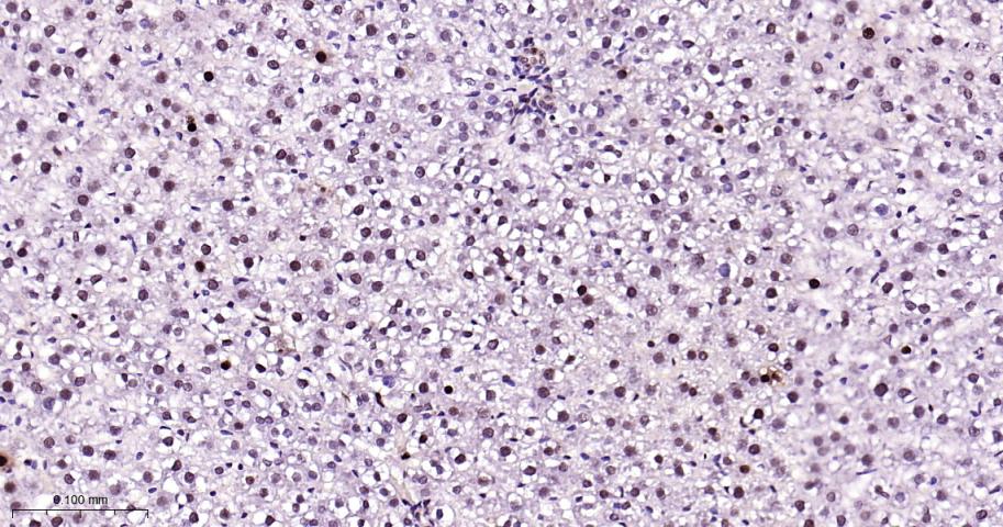 增殖细胞核抗原（内参）重组兔单抗
